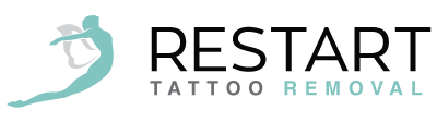 Restart Tattoo Removal